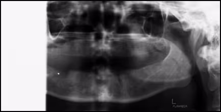 ce589 Shoulder–Receptor/X-ray Head Interference Errors - Figure 1